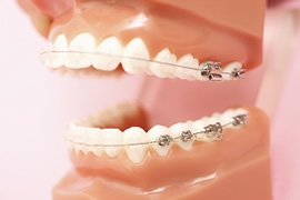 矯正歯科・セラミック治療・ホワイトニング